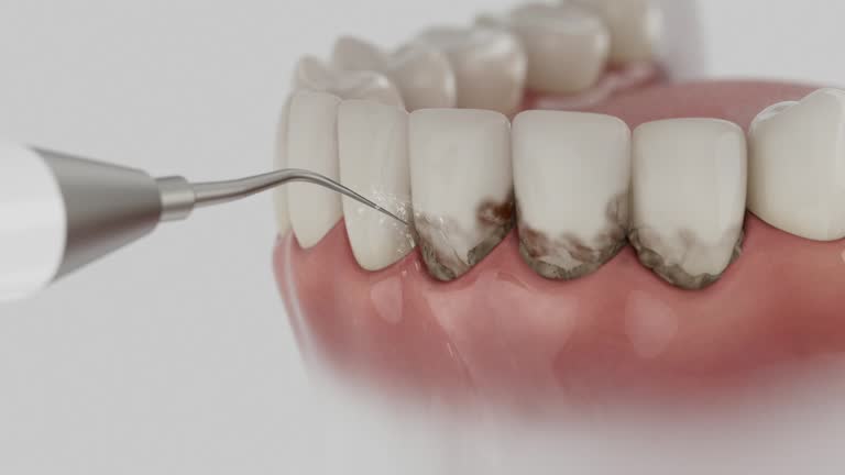 Reliable Tooth Extraction contractor in Bryant, AR by Smile Center Dentistry